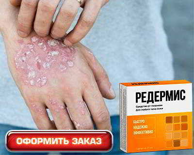 Редермис купить