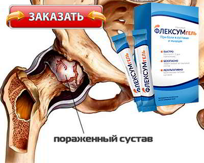 Флексумгель купить