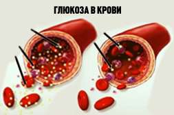 Состав Диафаста снижает и регулирует уровень глюкозы.